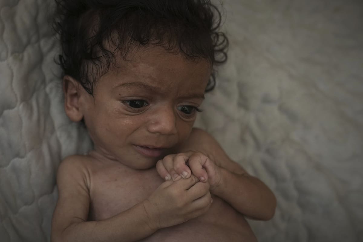 Qué se necesita para declarar una hambruna y por qué la situación en Gaza es tan compleja